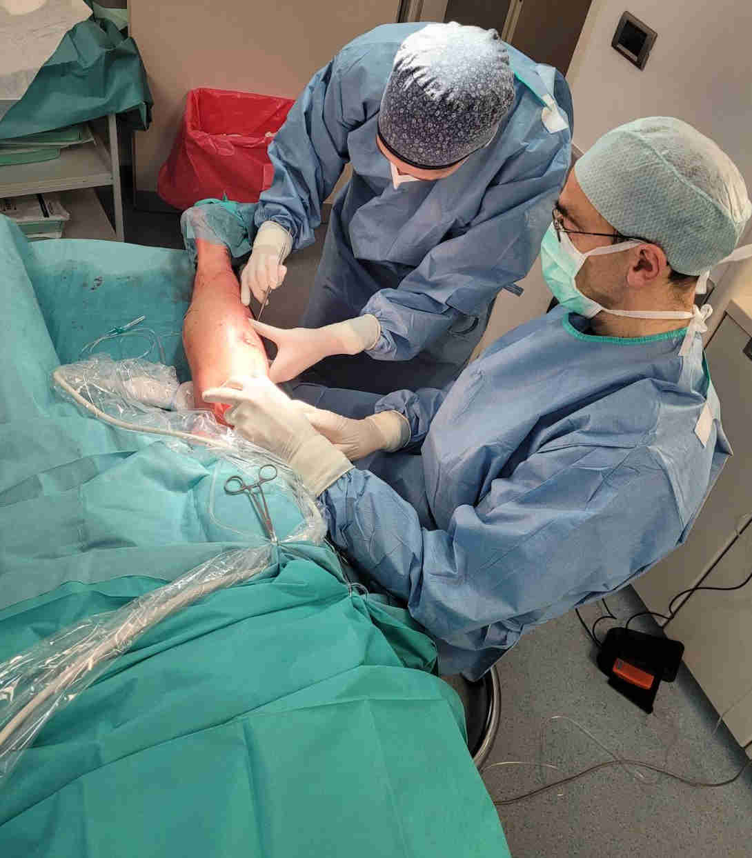 Po vstopu s kljukico v podkožje je naloga žilnega kirurga, da najde krčno žilo, ki se sicer v ležečem položaju rada skrije